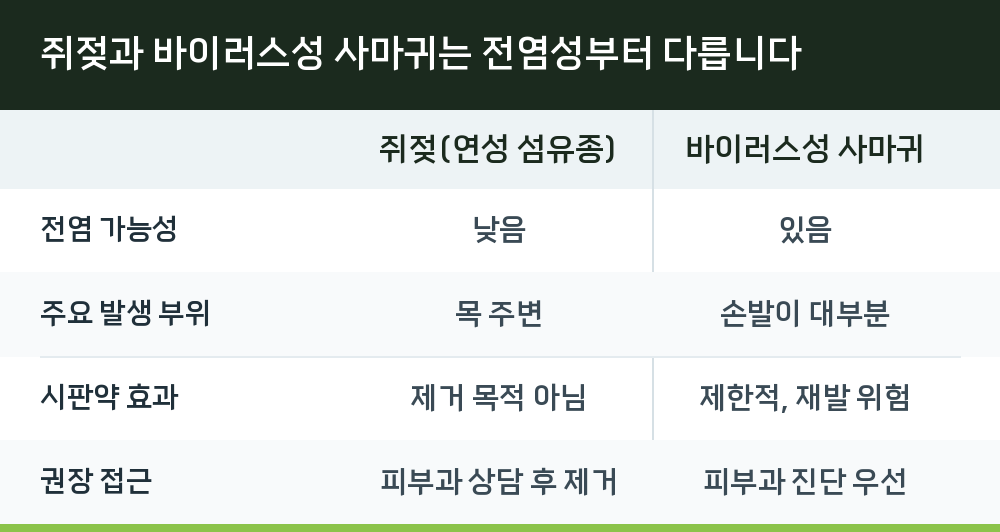 쥐젖과 바이러스성 사마귀는 전염성부터 다릅니다