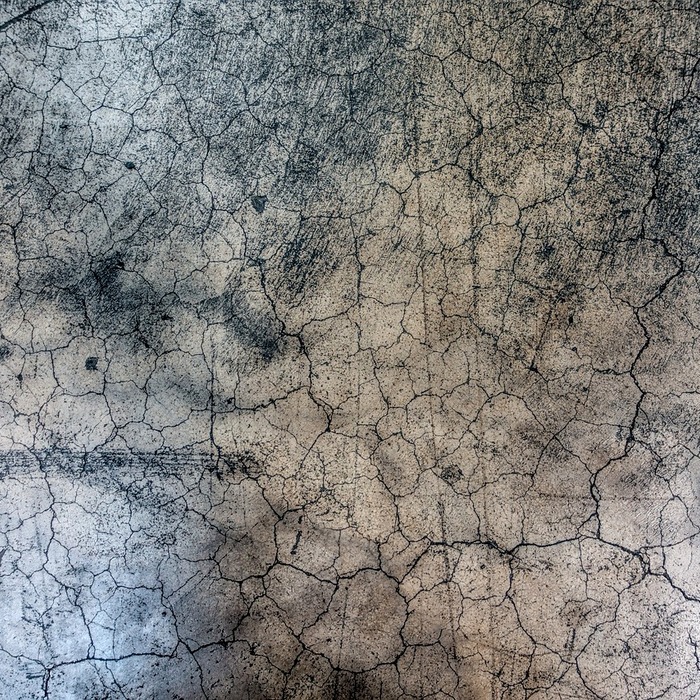 고관절 골절 증상