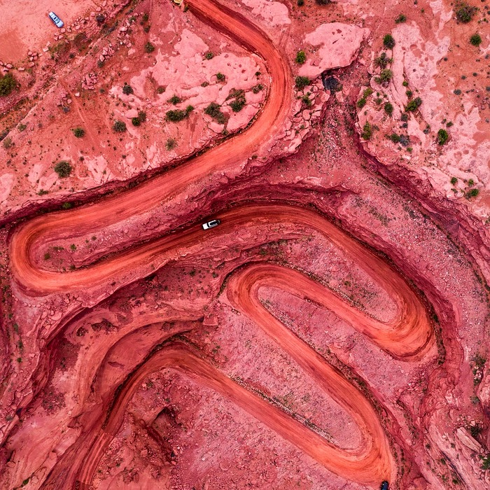 고관절 수술 방법